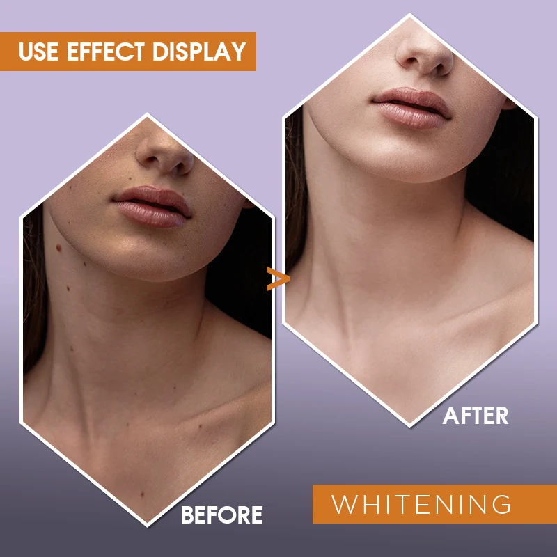 glutathione iv brisbane Glutathione IV in Hendersonville