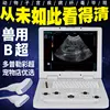 Doppler color ultrasound-with superficial large convex probes