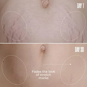 Private Label Belly Friming Cream Brazilian Peppertree Cream Clinically Proven Fades Stretch Marks Smoother Belly Cream