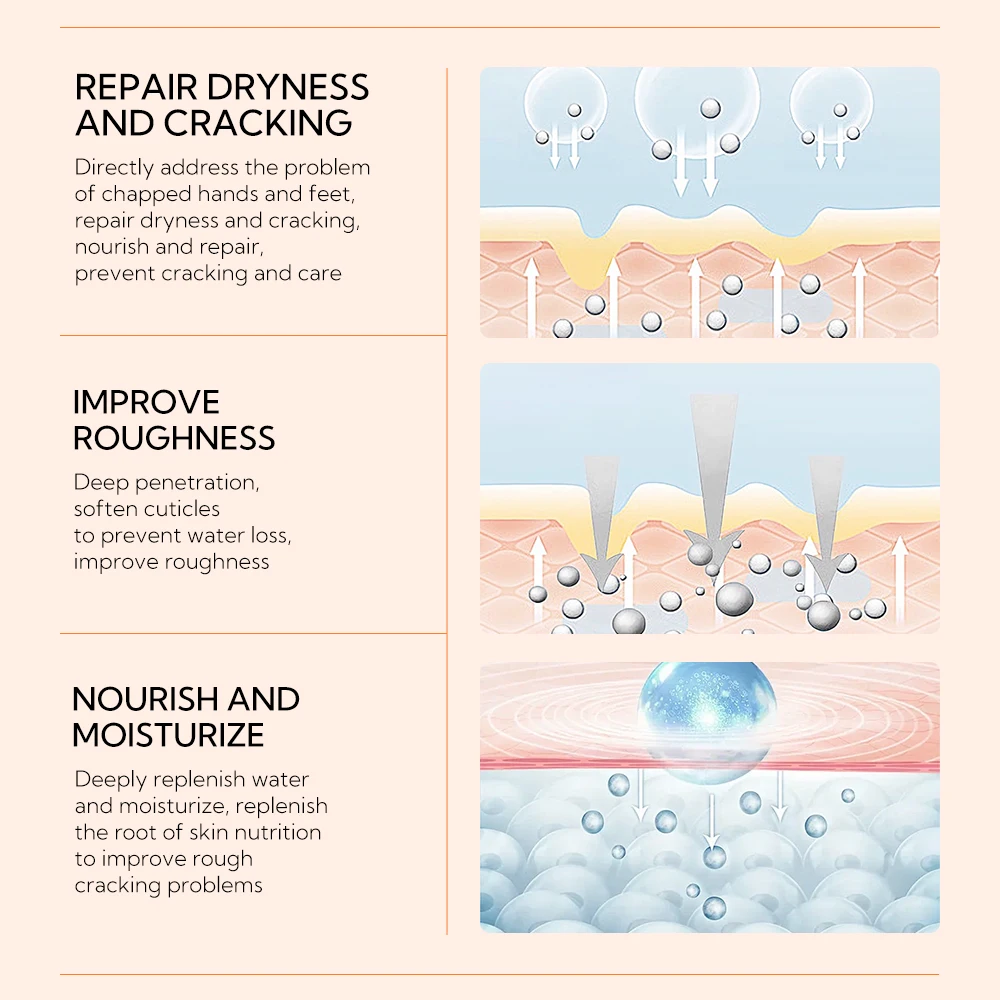 Lanbena Hot Peeling Dead Skin Removal Foot Repair Whitening Foot Cream details