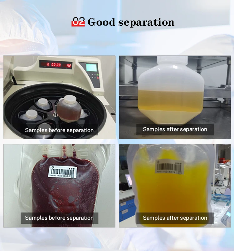 KAIDA DL6m банк крови охлажденный 6x1000 мл мешок крови тромбоцитов богатый центрфуга для получения плазмы