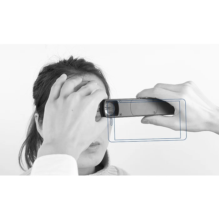 S150D China Ophthalmology 6X Portable Digital ORC Slit Lamp with Mobile Adapter App