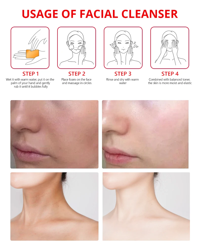 Guanjing Kojic Acid Soap Vitamin C Extract Deep Cleansing Even Skin Tone Brightening Skin Moisturizing Bathing Soap