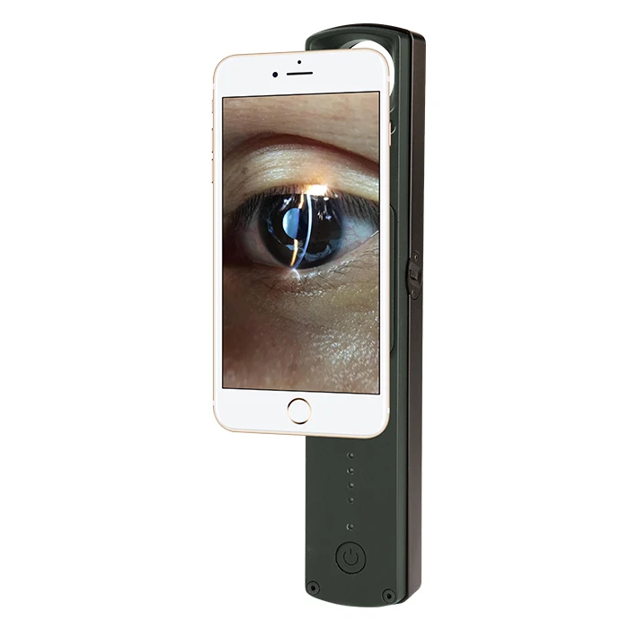 S150D China Ophthalmology 6X Portable Digital ORC Slit Lamp with Mobile Adapter App