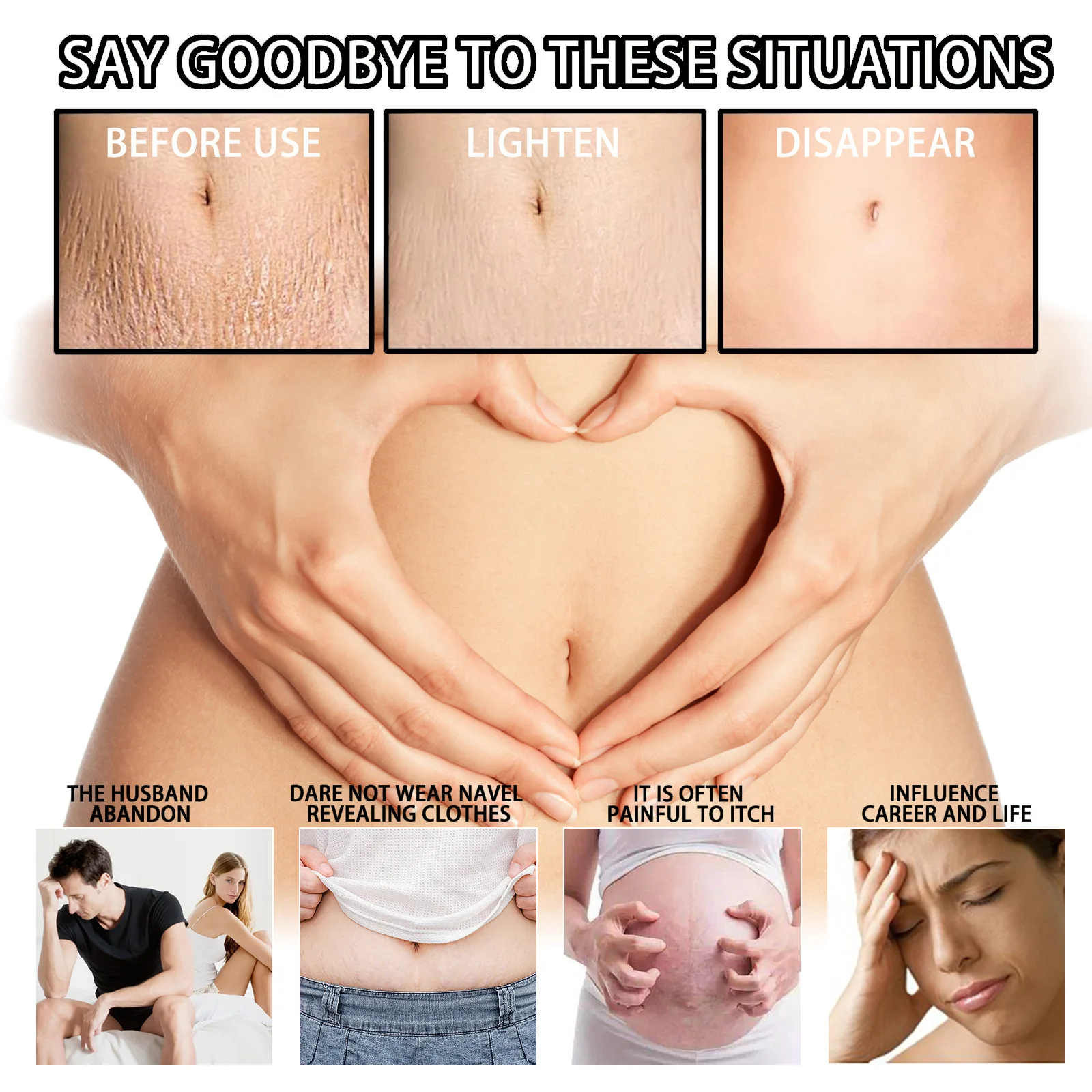 Hot Sale Vegan Stretch Marks Removal Cream Postpartum Body Care Repair Firming Stretch Marks Cream