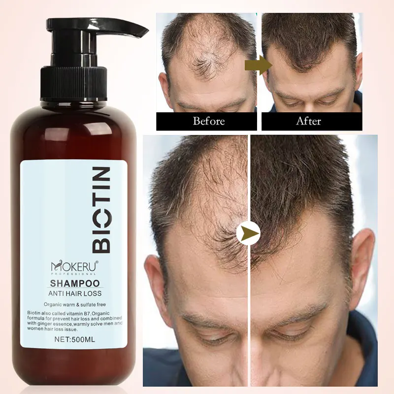 Biotin Collagen Korean Hair Beauty Condition Shampoo Prevent Hair Fall 100%  Sulfate Free Wholesale Custom Hair Shampoo - Buy Condition Shampoo,Custom  Hair Shampoo,Korean Shampoo Product on 