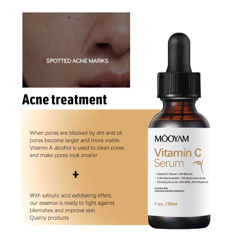 20 Vitamin C Serum With 2 Retinol 3.5 Niacinamide 5 Hyaluronic Acid