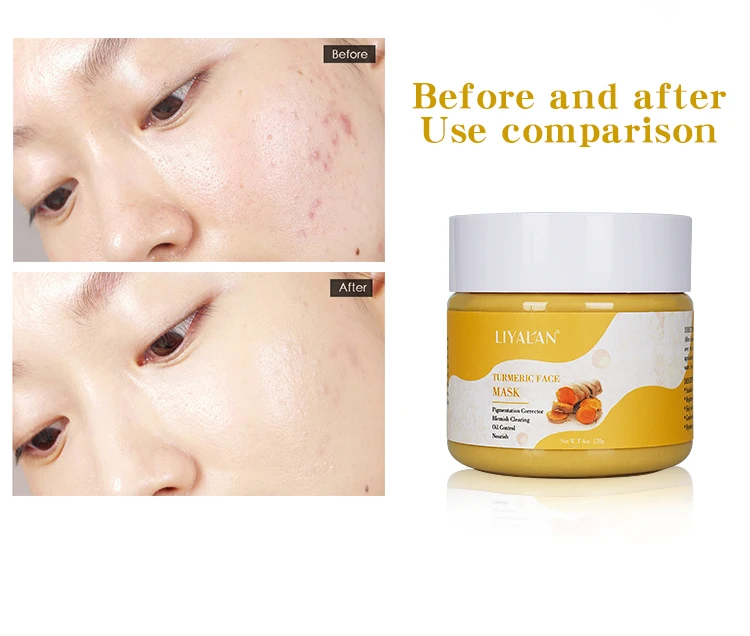 Oem Wholesale Private Label Organic Brighten Blackhead Removal Anti