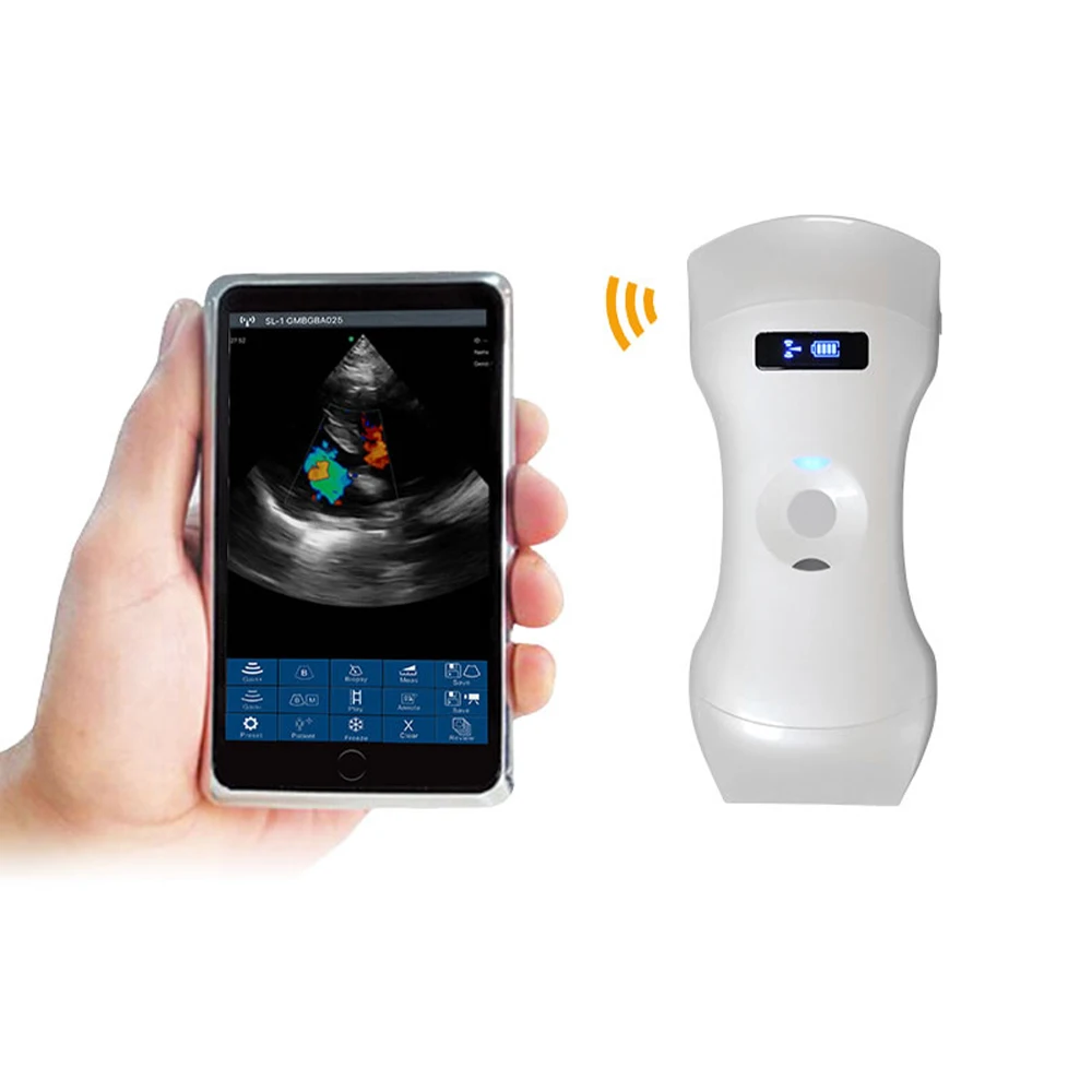 Suresult Urason W6 Wireless Ecografo Color Ultrasound Probe Scanner ...