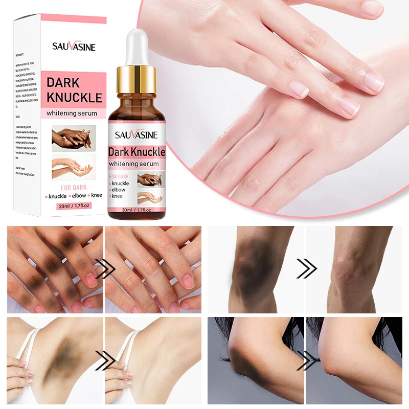 Dark Knuckles Bleaching Serum Sulfate-Free Nourishing Lightening and  Vitamin C Double Glutathione Super Skin Whitening Serum