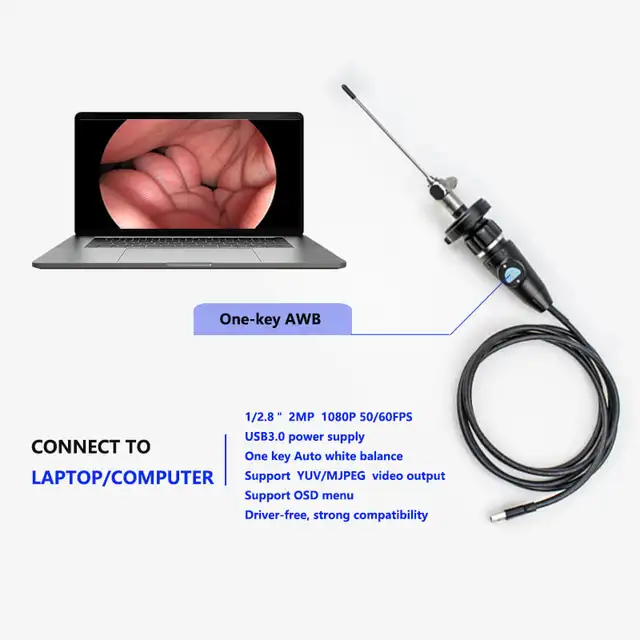 OEM Factory New USB3.0 Handle HD Medical Digital Inspection FHD Endoscope Camera