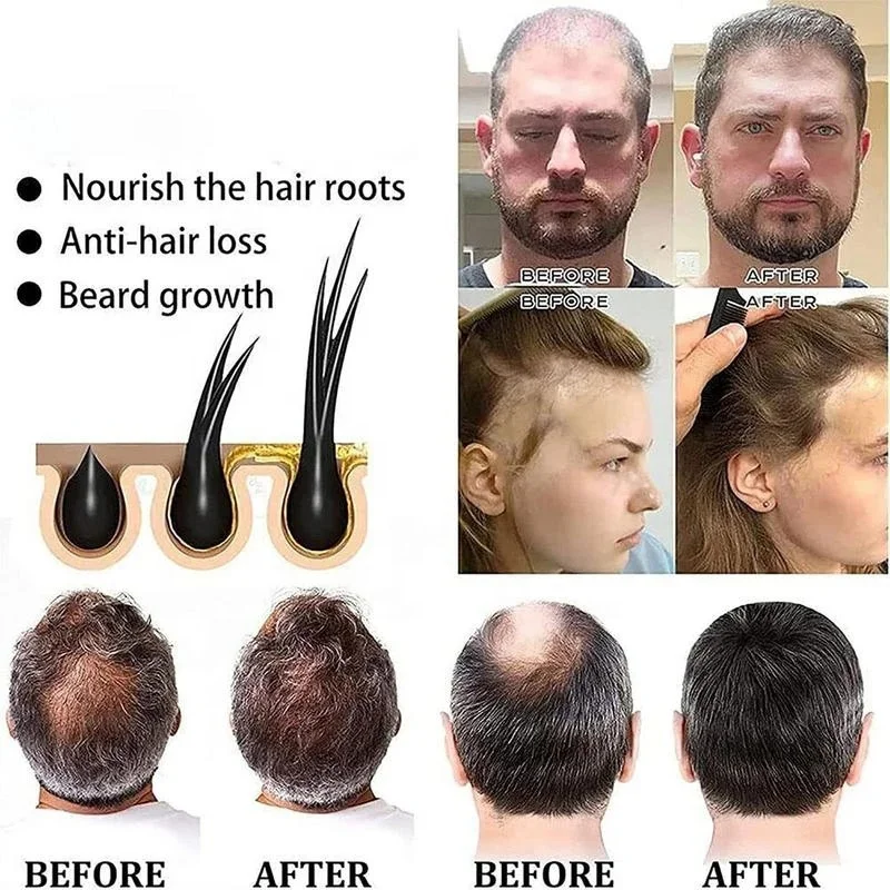 Moisturize Repair Hair/ Hair Growth /Prevent Lost/Anti-Dandruf  Bamboo Charcoal Polygonum  Hair Darkening  Shampoo Soap Bar