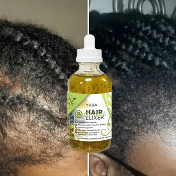 100% Natural Organic Rosemary Castor Almond Oil Men Women Scalp Care Serum Hair Treatment Growth Oil Private Label