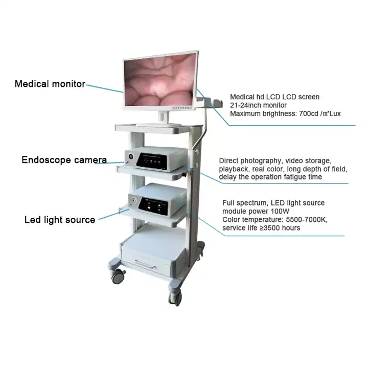 HD 1080P Video Camera medical endoscopy camera module Endoscope System for Ent factory