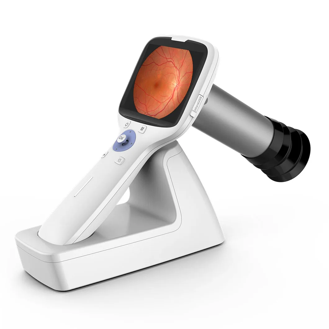 Big Discount Ophthalmic Diagnosis Portable Handheld Non-mydriatic Digital Fundus Retinal Camera