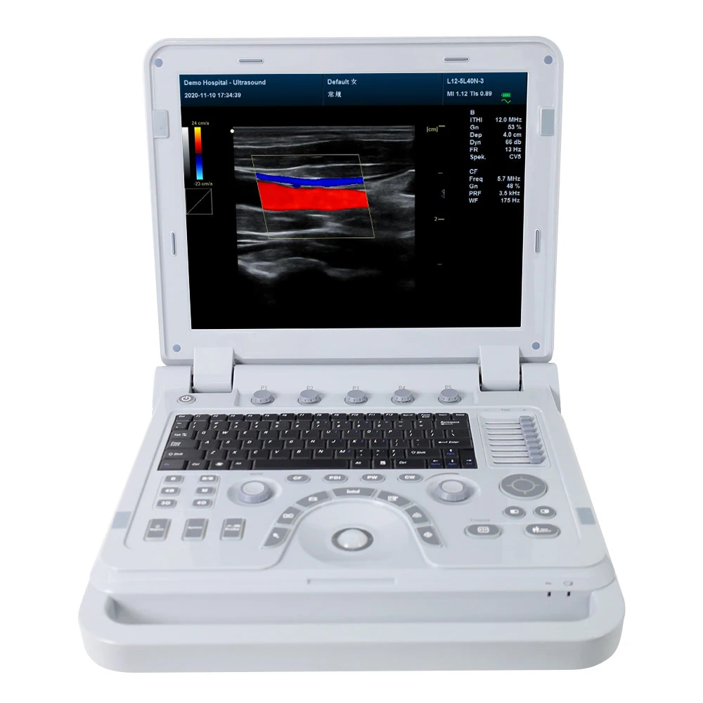 CONTEC CMS1700B Multiple 3D 4D Probe Digital Human Ultrasound Scan Ecocardiografo Color Doppler ultra Sound Machine