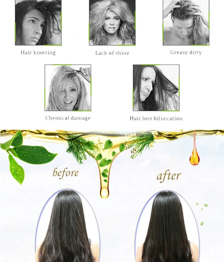 BLIW Private Label 30ml 50ml 100ml Hair Growth Serum Moisturizing Hair Growth Oil Drops Biotin For Hair Growth