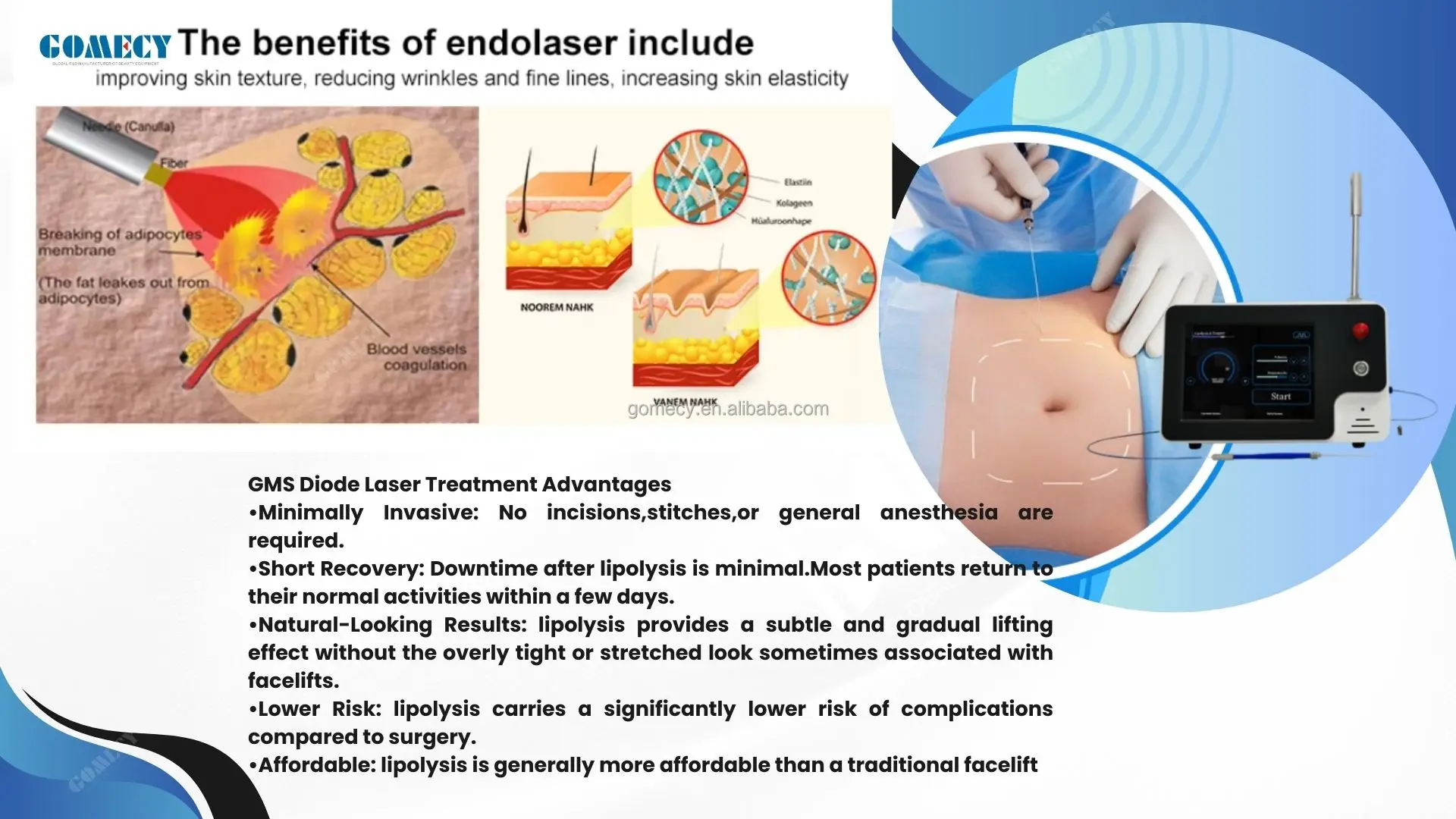 2026 Endolaser Machine Face Lifting Laser 635nm 1470nm 980nm 3 ...
