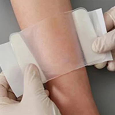 Wide Varieties Hydrogel Burn Wound Care Dressing - Effective ...