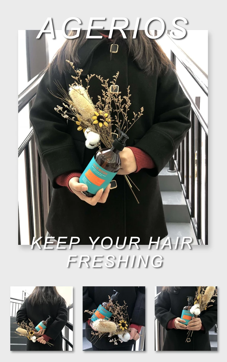 agerios hair loss 9