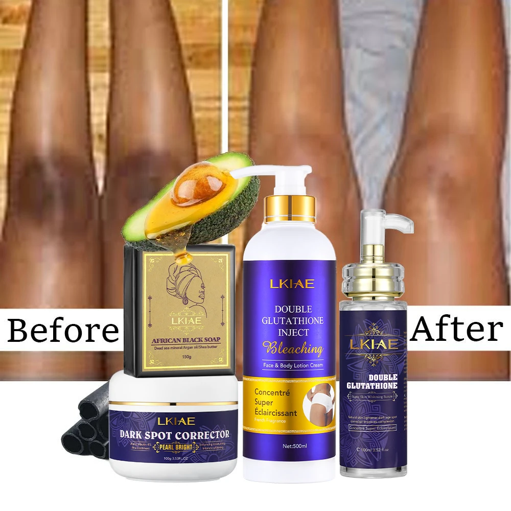 Private Label Double-glutathione Organic Get Rid of Dark Knuckles in 7 Days  Face Cream Serum Whitening Body Lotion Skin Care Set