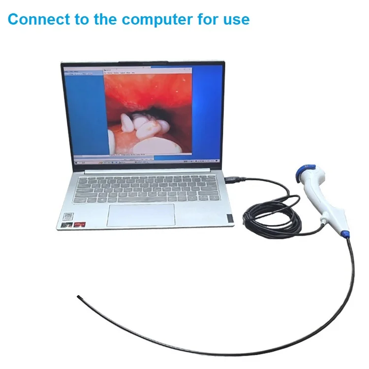 Single Use Pyeloscope Hot Sale Reusable Flexible Fiber Ureteroscopy Medical Equipment Light ...