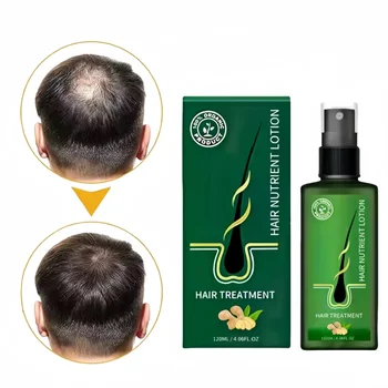 Customized hair growth supplement spray Promotes Hair Follicle Growth hair growth essence spray