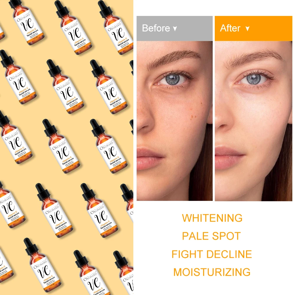 Organic Pure Vitamin C Serum For Face,Acid Whitening Brightening