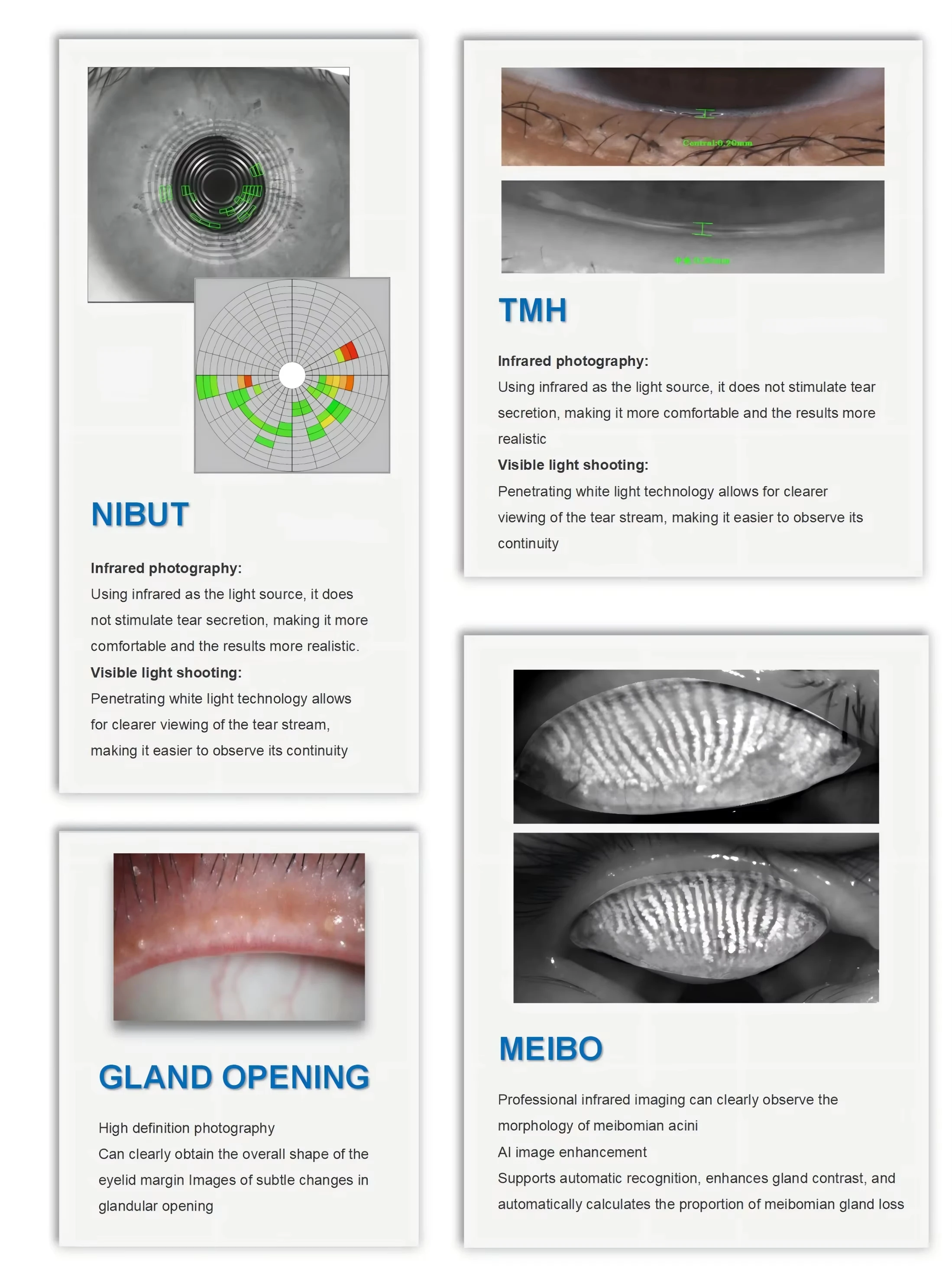 Dry Eye Examination Ocular Surface Analyzer Dry Eye Analyzer Ophthalmic Equipment