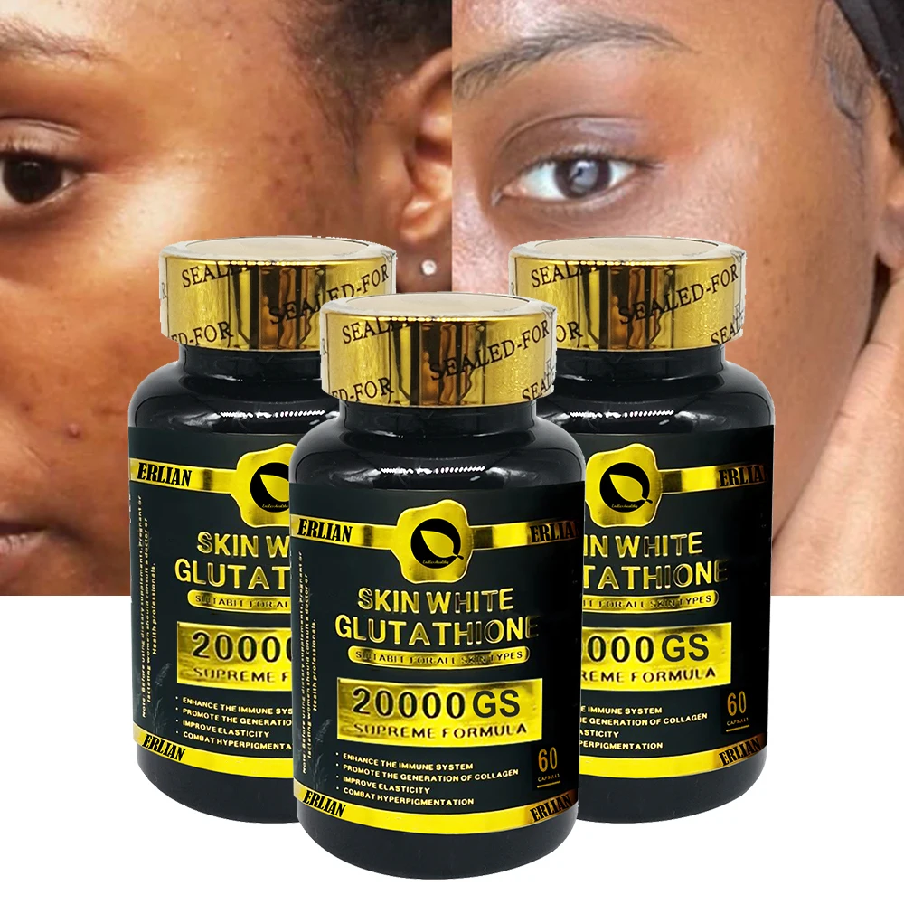 cathy doll l glutathione ampoule review Honest review of the Cathy Doll L-Glutathione Collection ,   https://vt.fiktok.com/ZSBUnu4C4/,  https://vt.tiktok.com/ZSBUnyUmM/,   https://vt.tiktok.com/ZSBUnSmwt/, @heydolliesph @cathydollclub