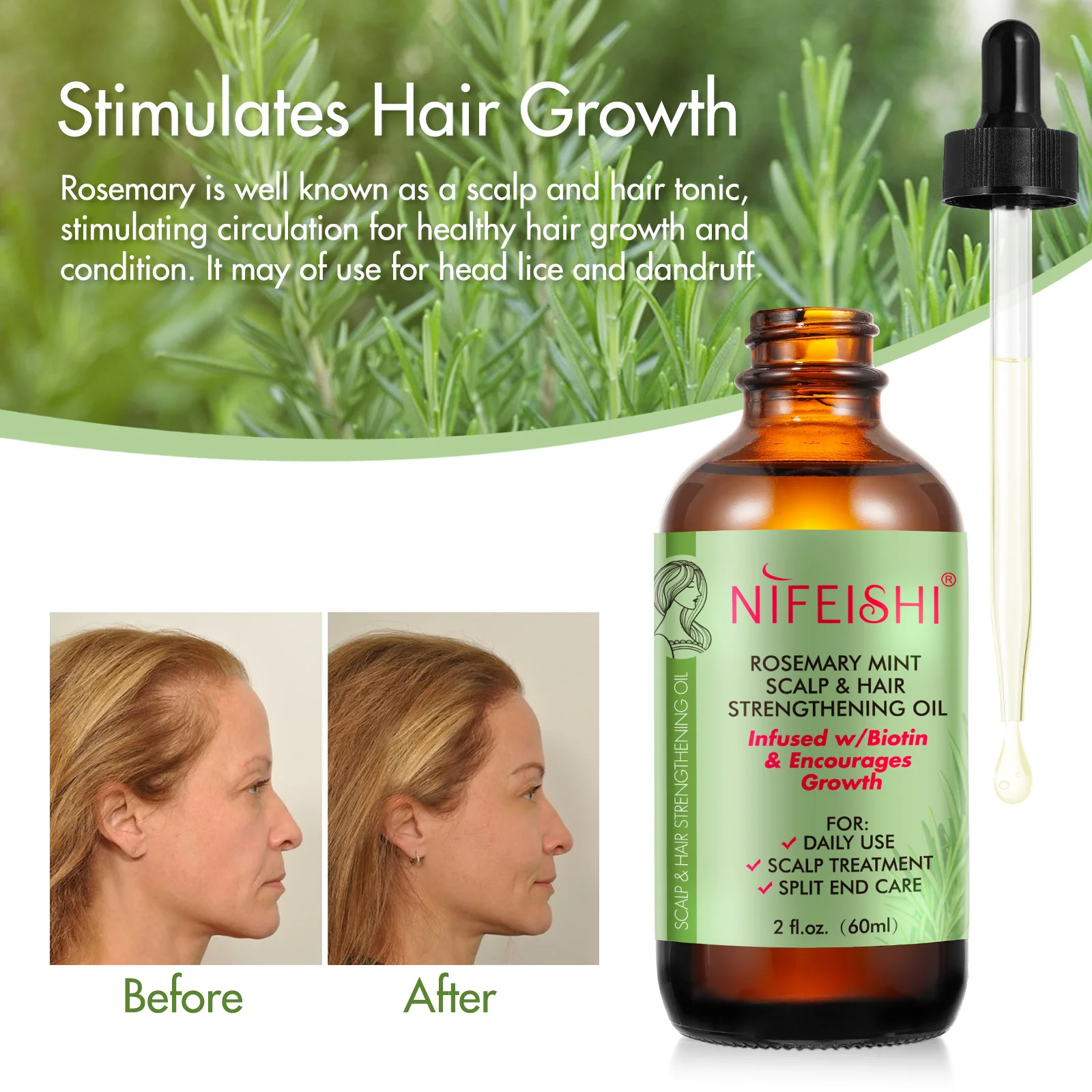 Nifeishi Rosemary Mint Scalp Hair Strengthening Oil,60ml Organic ...