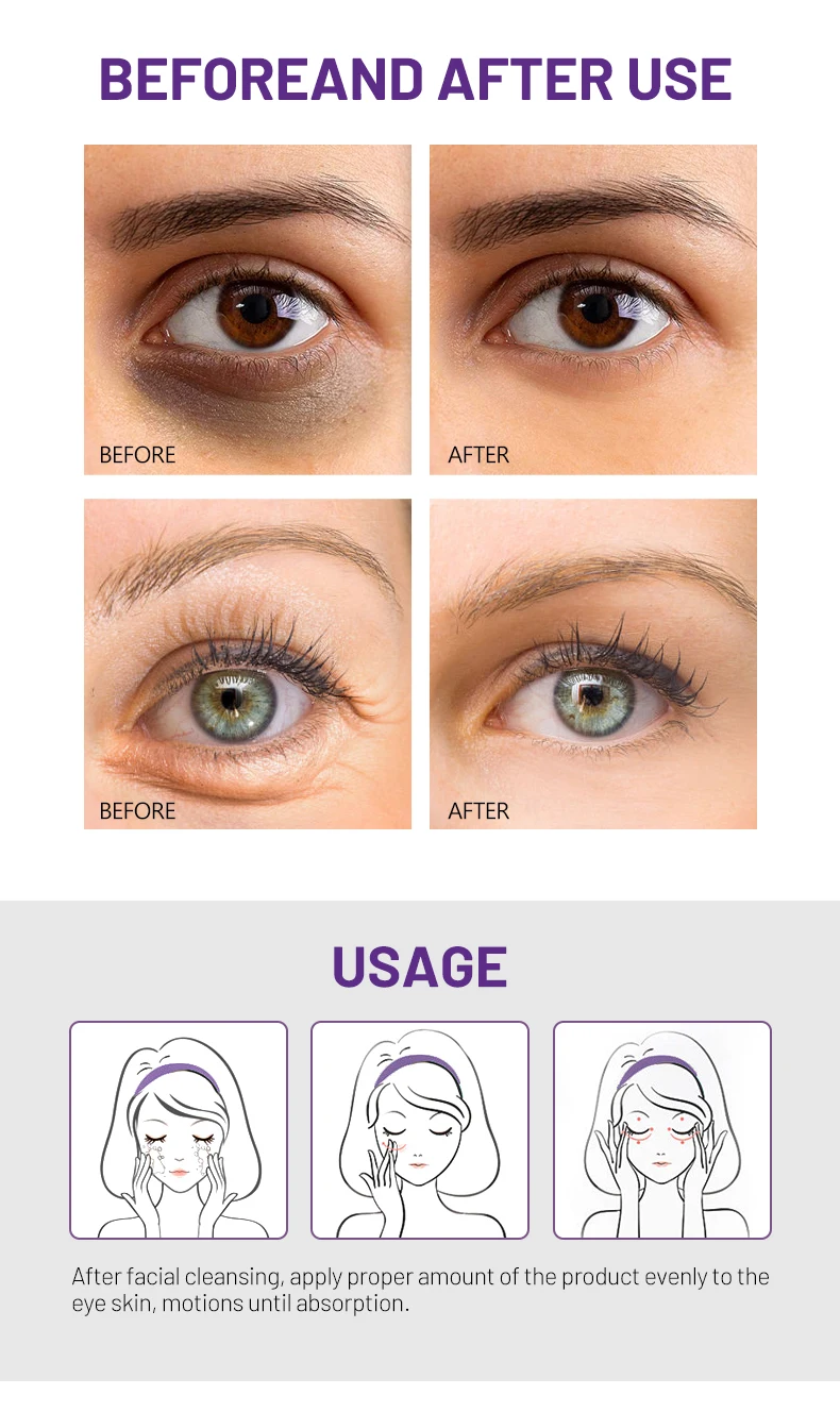 Retinol Repair Eye Cream Firming Lifting Reduce Wrinkles Fine Lines Caffeine for Dark Eye Circle Eye Problem