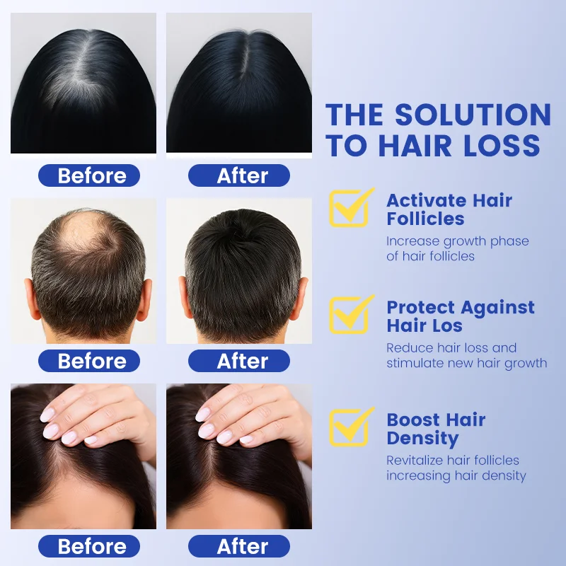 ahk cu for hair growth Amazon.com: Copper Peptide Hair Serum with Copper Tripeptide-1 – Dual  Peptide Scalp Treatment plus Licorice Root Extract : Beauty & Personal Care main image 0