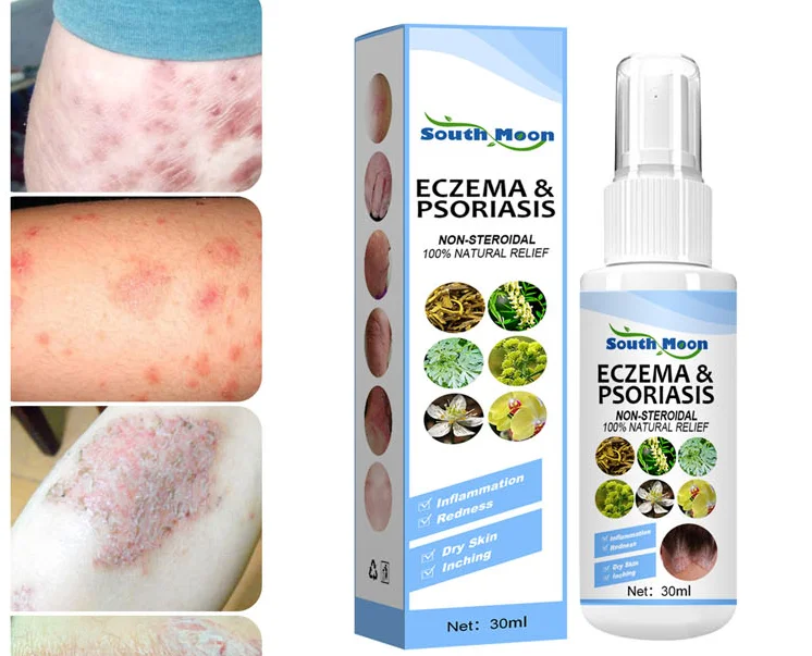 Spray de psoriasis 3PCS, Spray de traitement du Algeria