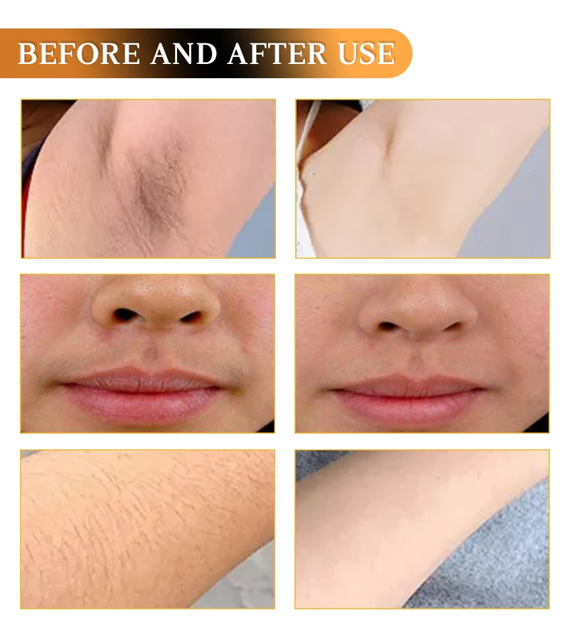 Aurora Quality Control