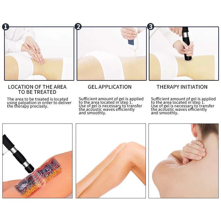 Профессиональное оборудование для электромагнитной ударной волновой эректической дисфункции, оборудование для ударно-волновой терапии, оборудование для ударно-волновой терапии