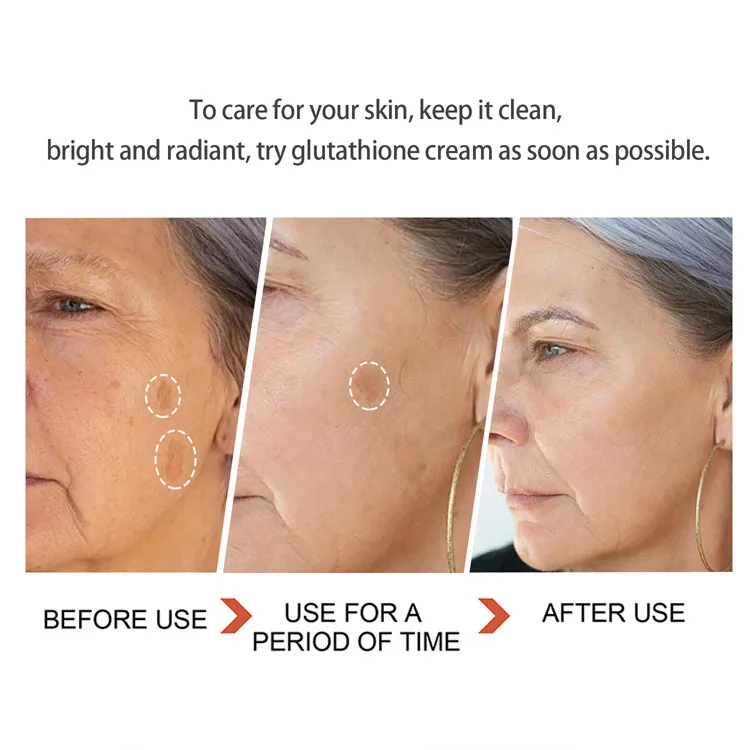 how many milligrams of glutathione should i take daily Lanthome Whitening Face Cream - Glutathione & Vitamin C for All Skin Types