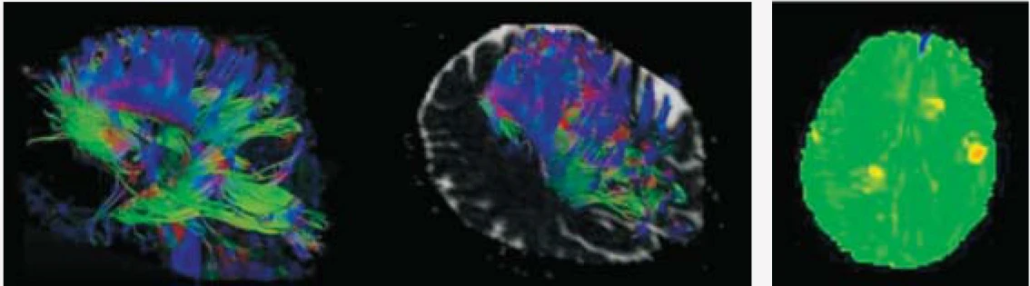 Hospital Medical Magnetic Resonance Imaging System 1.5T  MRI Machine with A-combi and Al Technologies manufacture