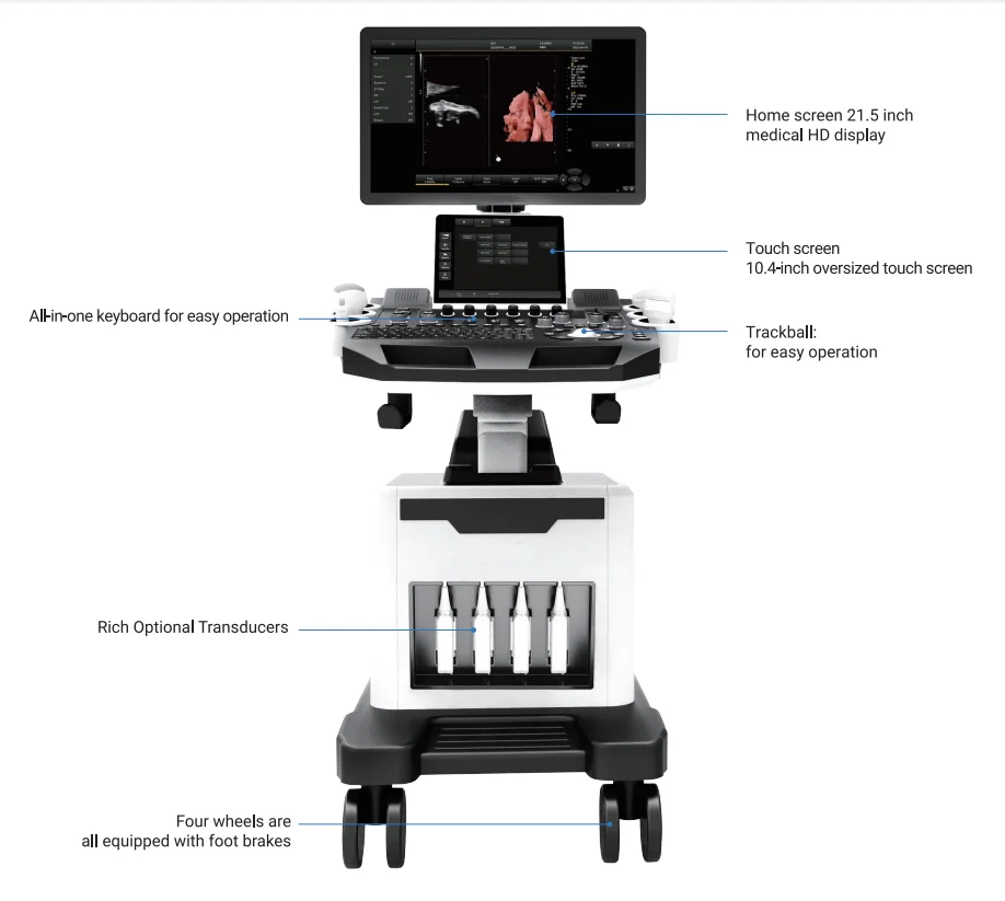 color ultrasonic diagnostic apparatus 