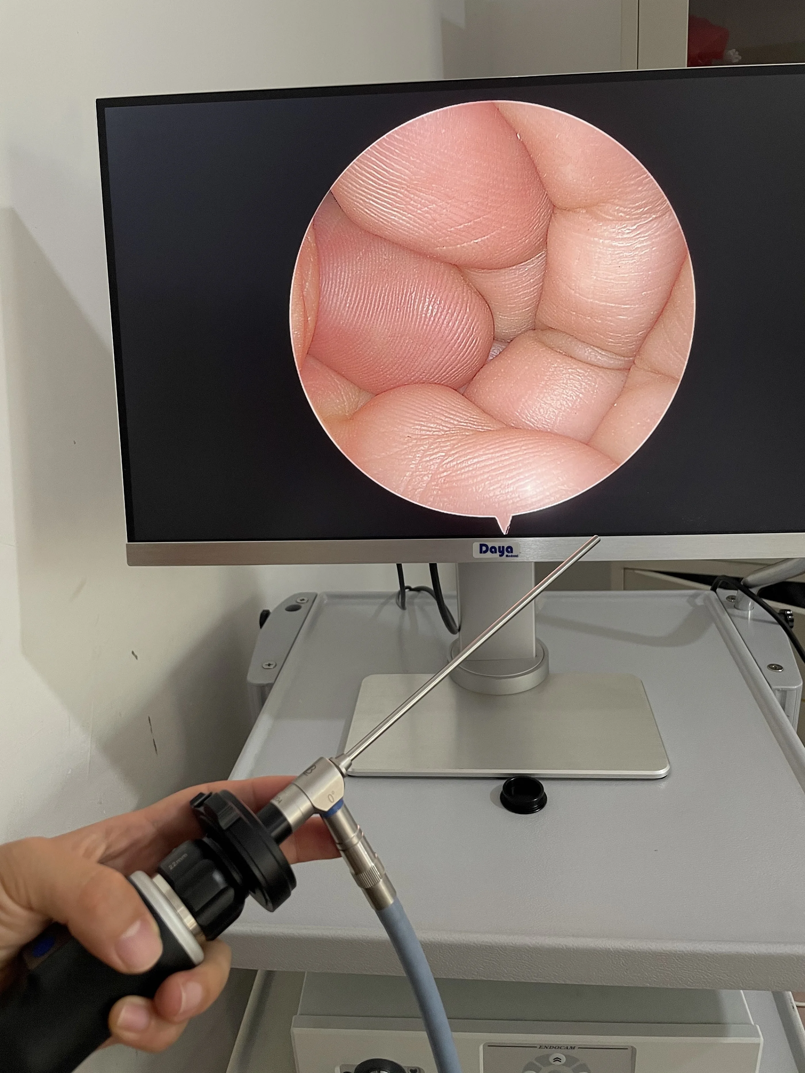 Endoscopy Monitor Laparoscopy Surgery Monitor Medical Grade Monitor