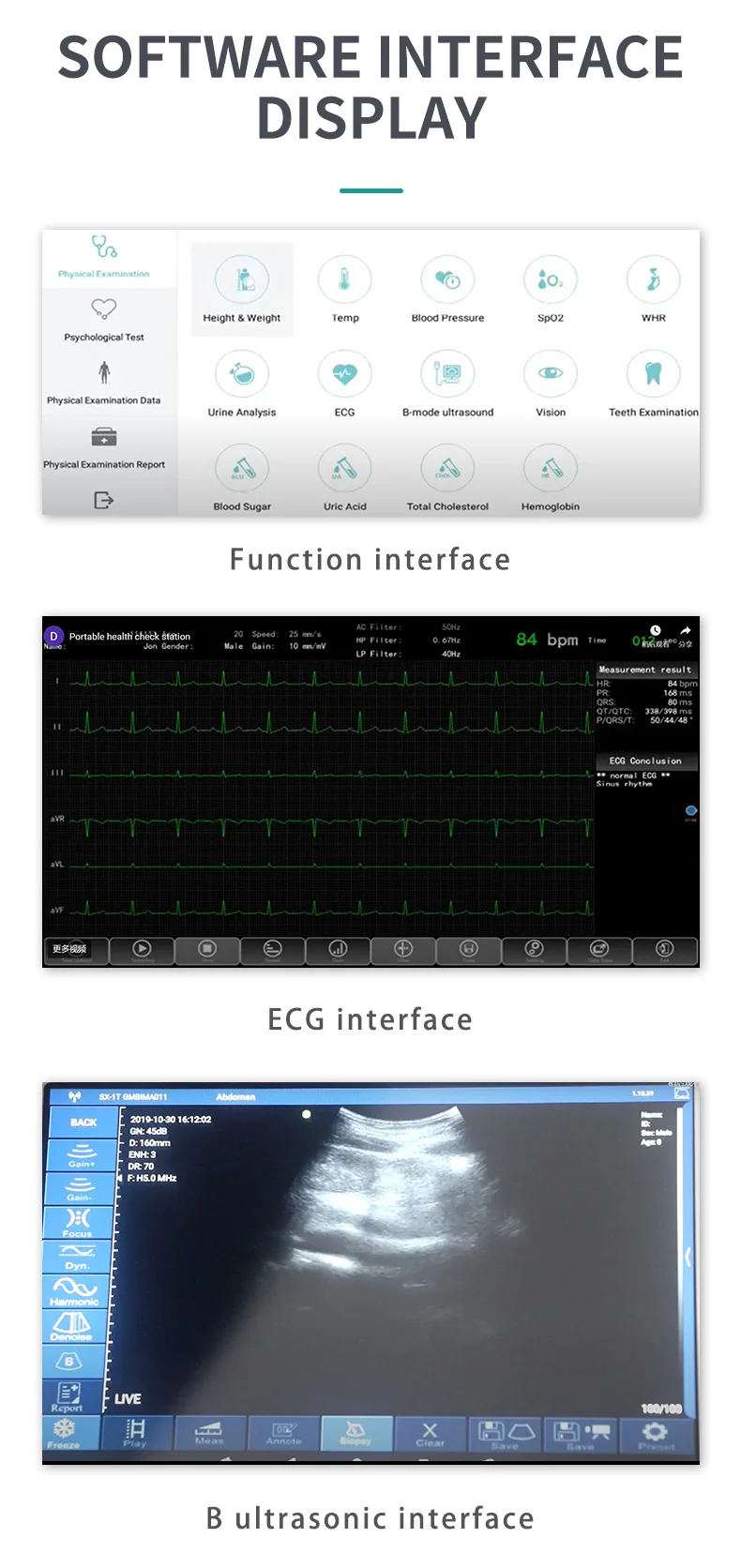 product full analysis blood pressure meridian health diagnostic body chekup machine-63