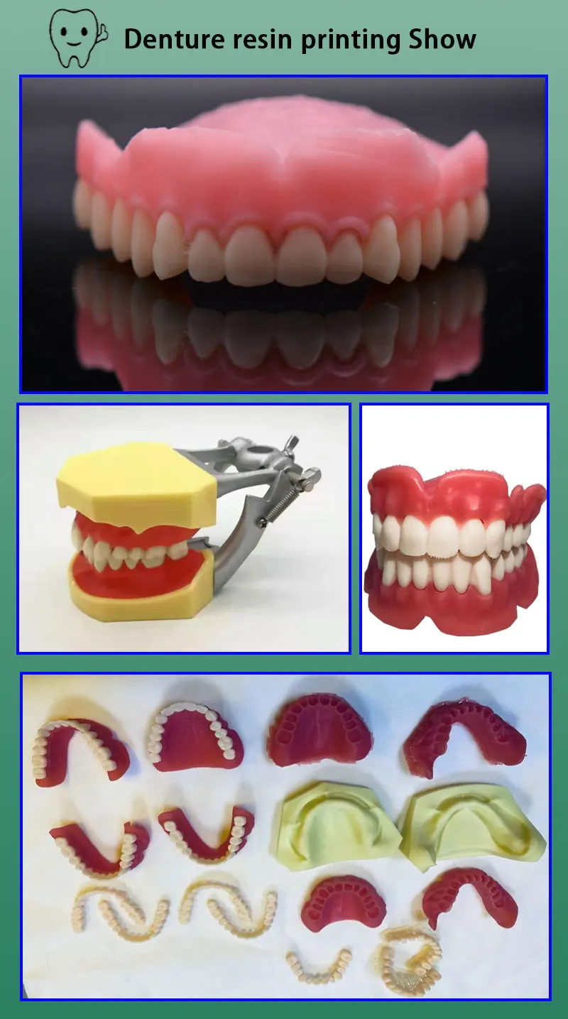 High Precision Pink Color 405nm Resin 3d Dental Resin