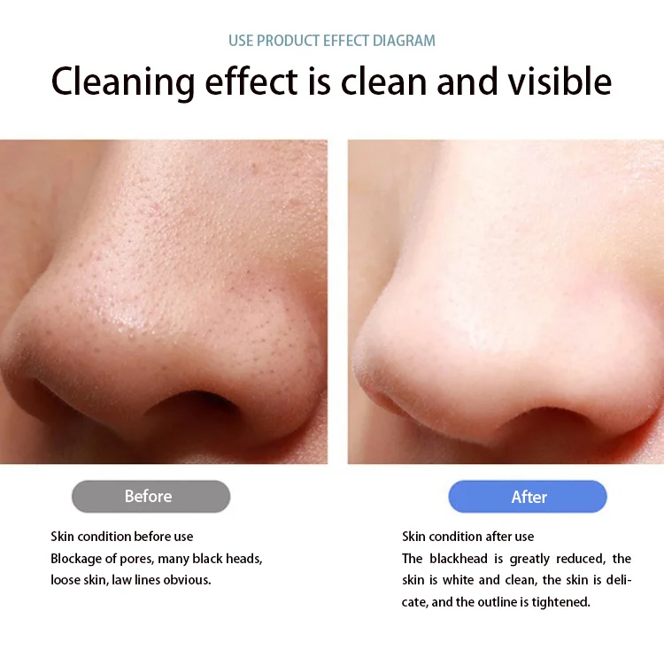 fashional Deep Cleaning Exfoliators rechargeable home use dead skin Blackhead Remover ultrasonic facial skin scrubber