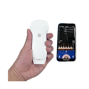 Portable Handheld Ultrasound Probe WiFi Wireless Ultrasound Scanner Color Doppler USG with Convex Linear and Cardiac All in One