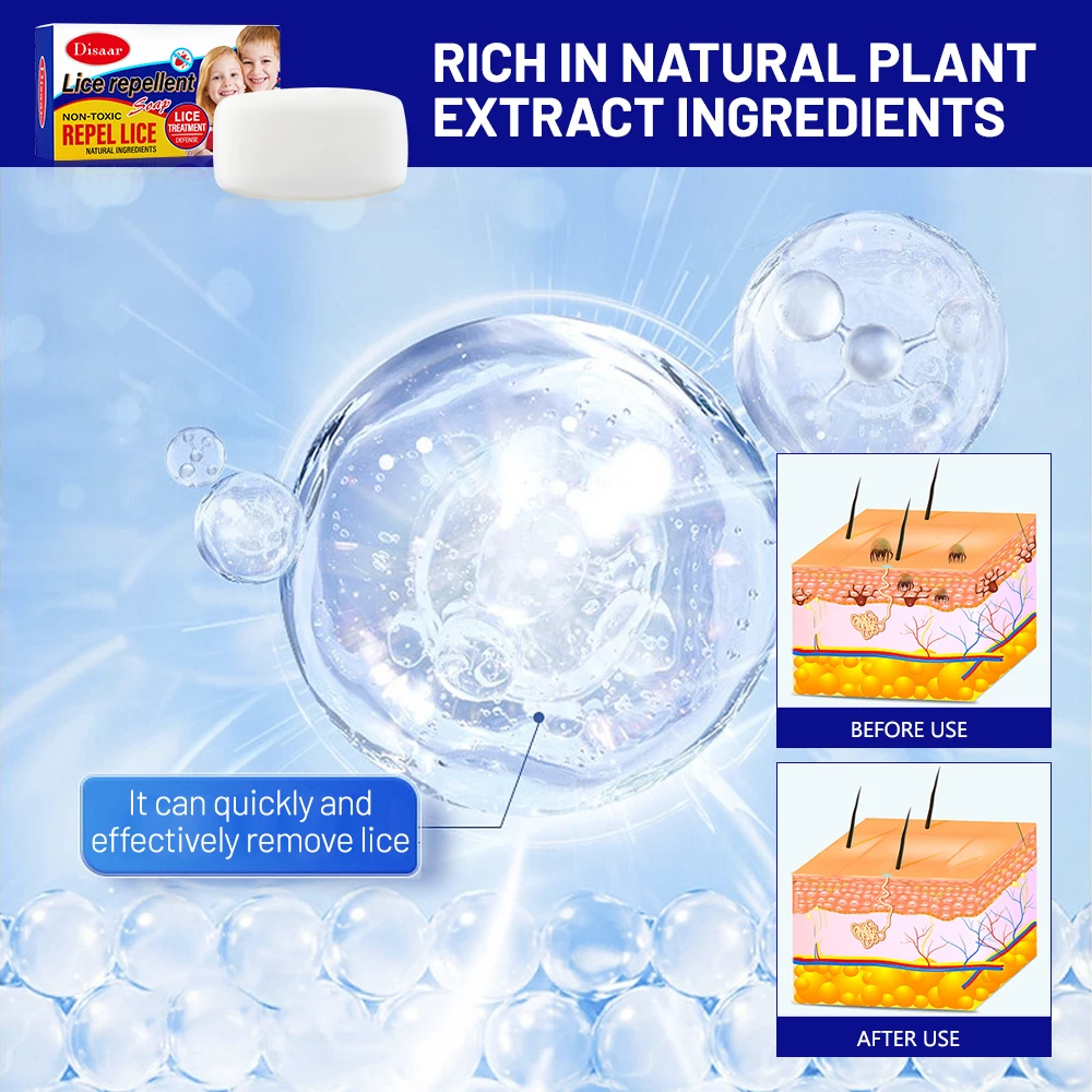 Peppermint & Lemon Extract Refreshing Oil Control Repel Lice Relieve Itching Lice Repellent Soap for Lice Remover Treatment