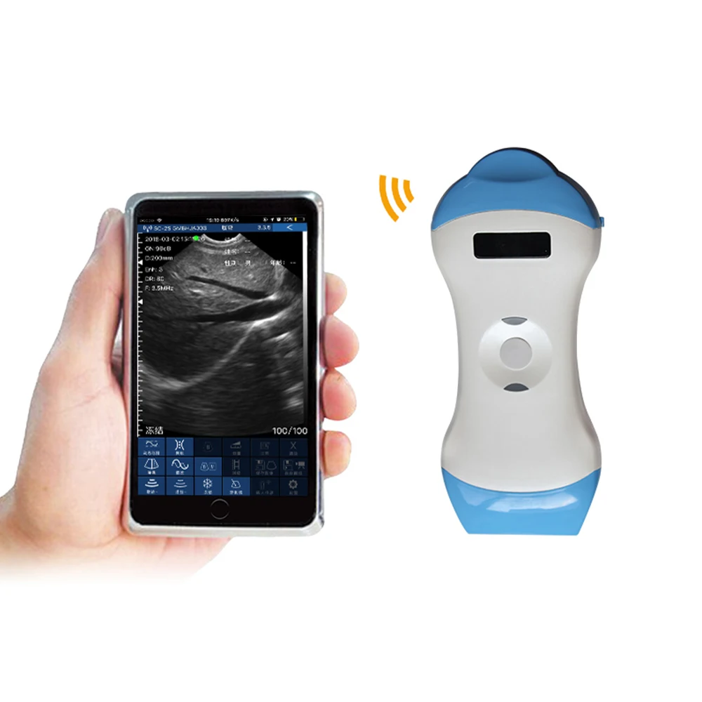 SURESULT D2LM Linear Micro Convex Transductor De Ultrasonido De Matriz Lineal De Alta Frecuencia Color Doppler