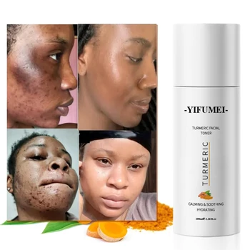 Private Labels Dark Spot Vegan Organic Hydaring Whitening Anti Age Acne  Moisturizing Brightening Face Spray Turmeric Toner