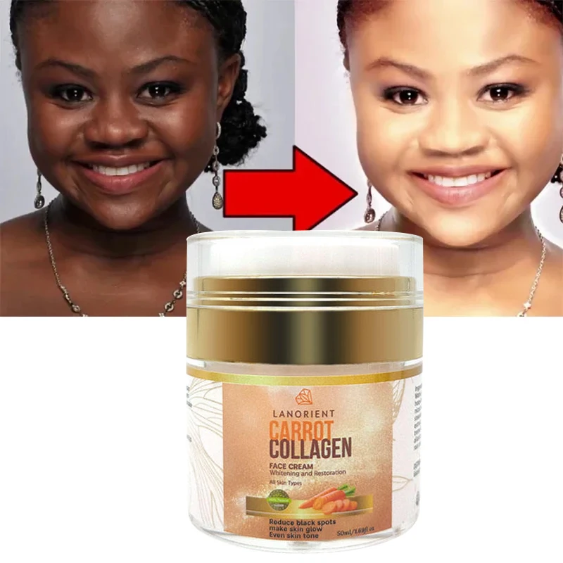 Private Label LANORIENT Korea Skin Care Products Natural Organic Vegan Carotene Whitening Skin Face Cream for All Skin Types