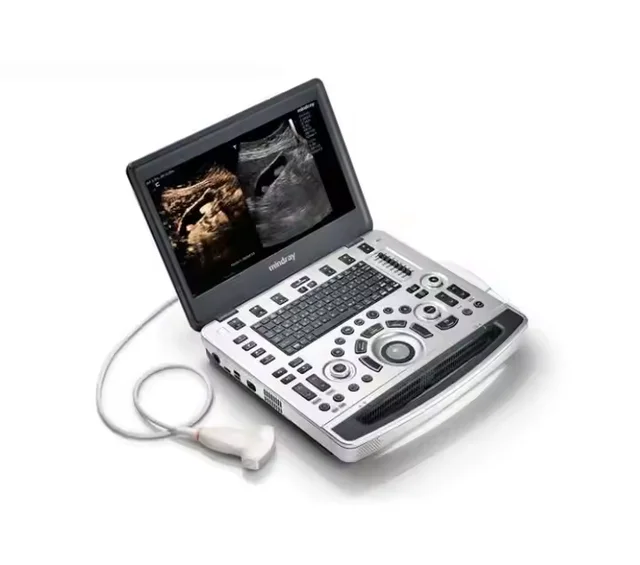Portable Color Doppler Mindray M9 Ultrasound Diagnostic Machine with Probe/Tranducer/Sensor