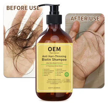 OEM ODM Private Label Anti Hair-Thinning Biotin Shampoo 500ml Organic Vegan Anti Hair Loss Hair Shampoo For Men